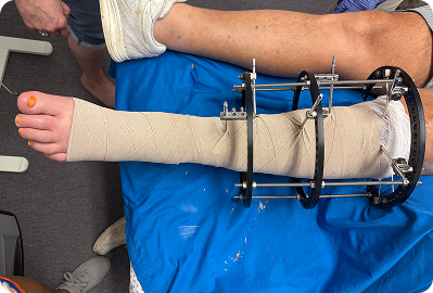 Custom Compression & Bandage Solutions